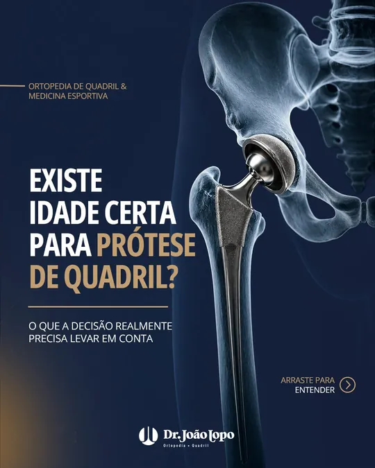 Post do Dr. João Lopo sobre a idade certa para a prótese de quadril
